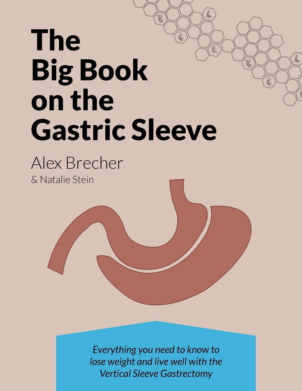 Gastric Sleeve Showdown: Tested Tips for Real Weight Loss