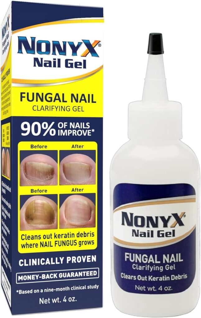 Best Health & Beauty – NONYX Fungal Nail Clarifying Gel Review