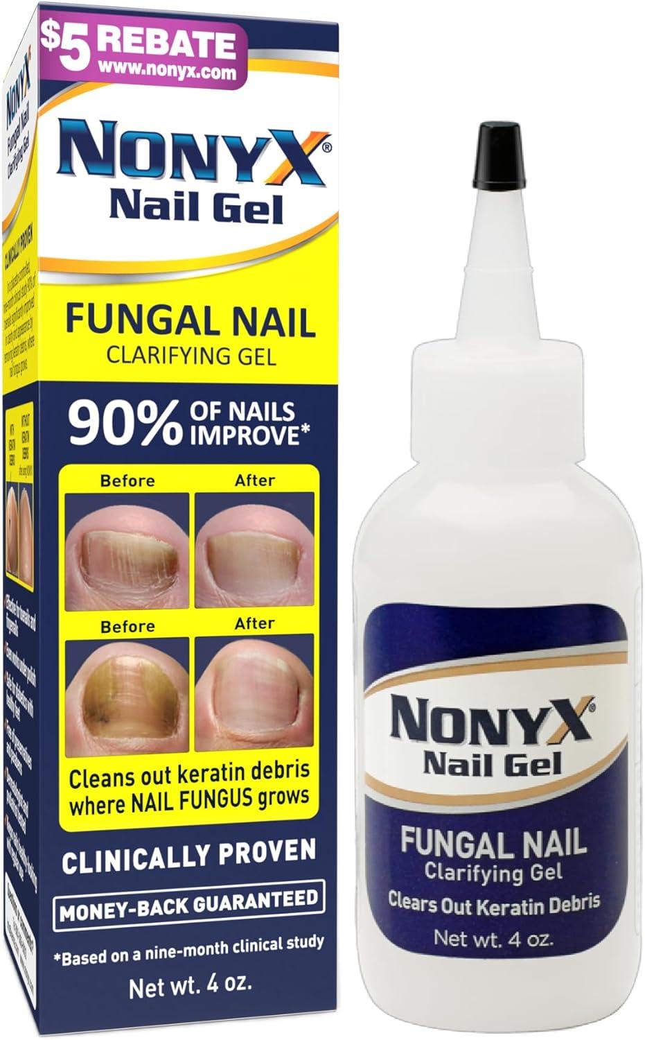 Clarifying Gel vs. Discoloration: tested, surprising, USA-made toenail fix