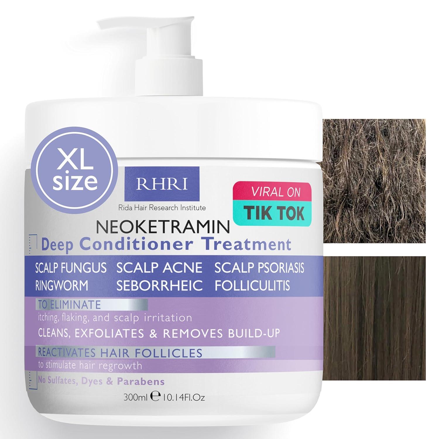 Anti-Fungal Deep Conditioner Showdown: Surprising Itchy Scalp Relief Tested