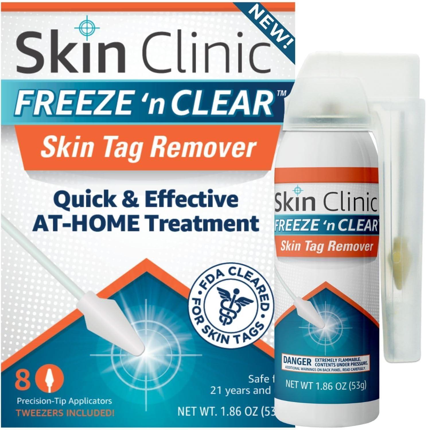 Surprising Showdown: Freeze vs Plasma Tested for Safe Skin Tag Removal