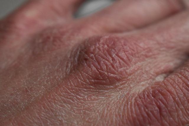 The best moisturizer face for dry skin that keeps your skin soft and hydrated
