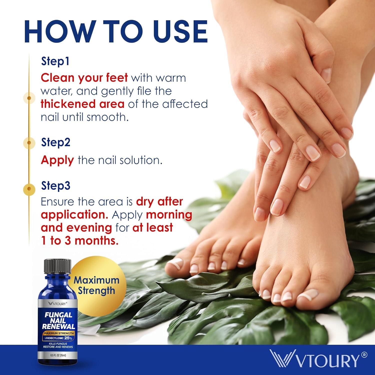Best Toenail Fungus Treatment - Extra Strength VTROUY Solution Review
