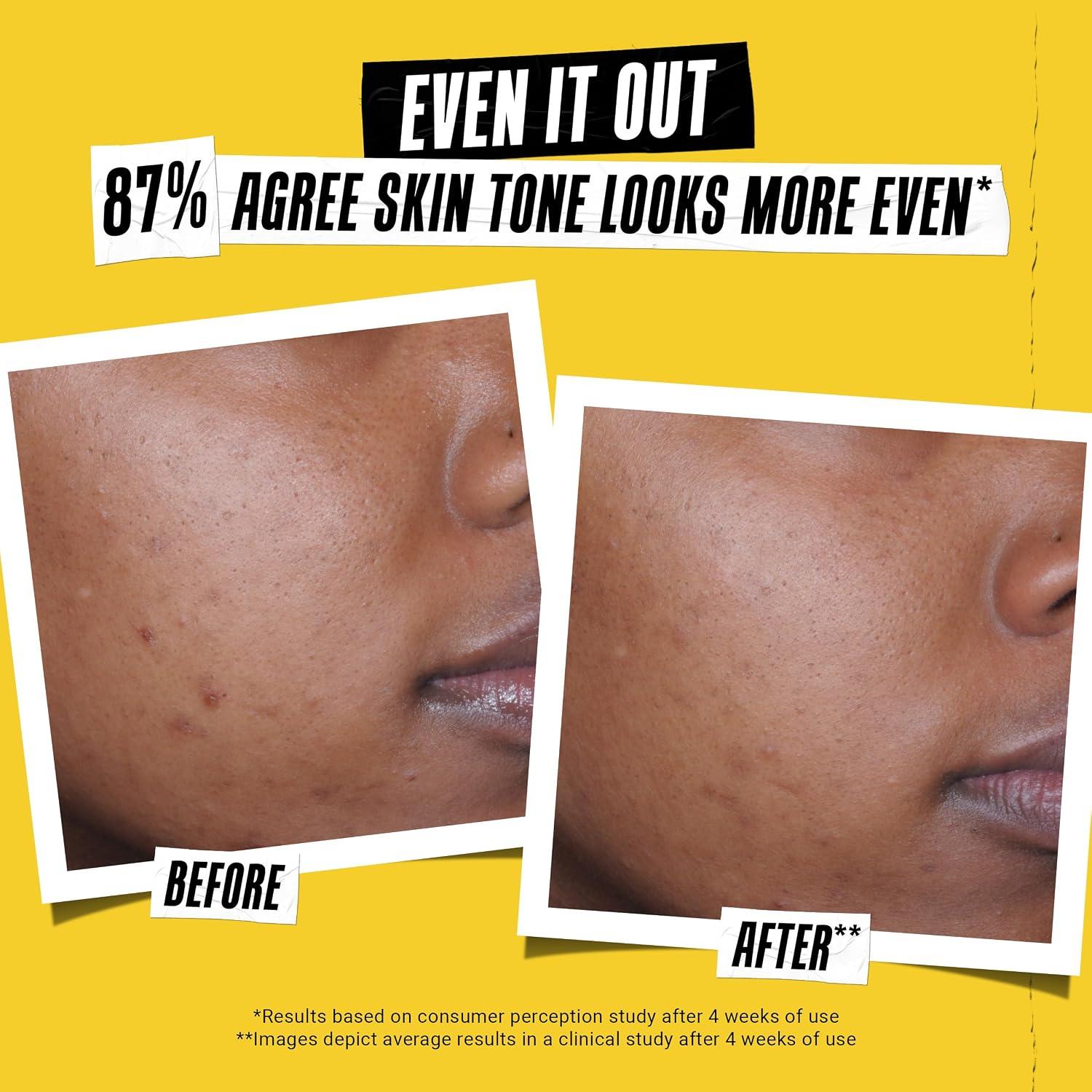 Best Facial Sunscreen - Kiehl's Better Screen UV Serum SPF 50+, Invisible Face Sunscreen Review