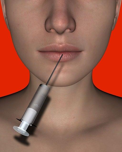 Lip Injections for Fuller Lips Looking Natural?