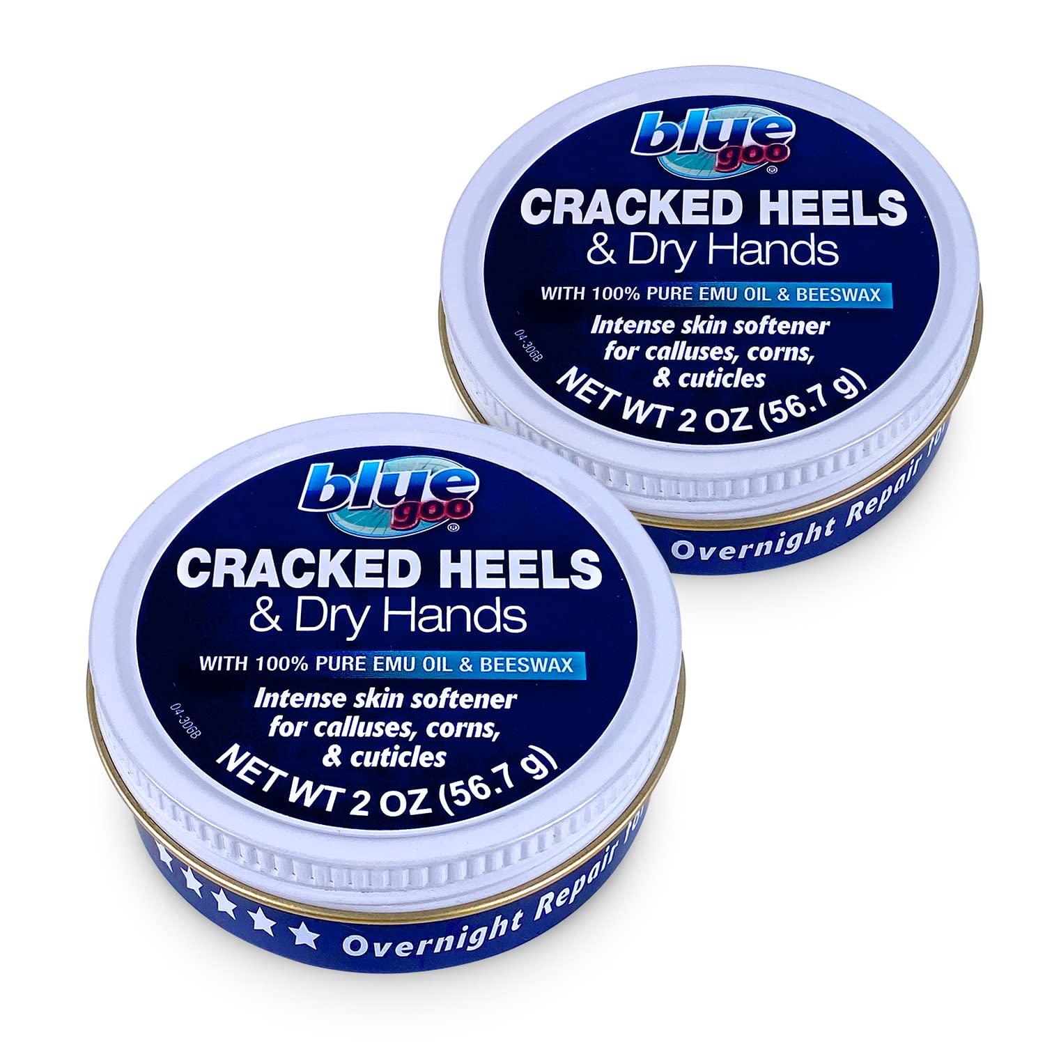 Best Heel & Hand Moisturizer - Blue Goo Cracked Heels & Dry Hands Intense Skin Softener Review (End of ANSWER)