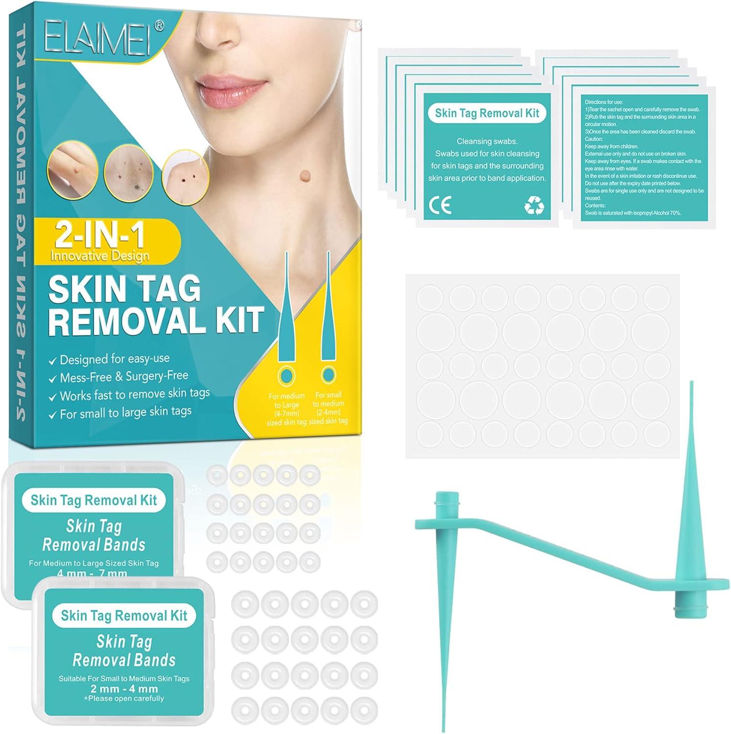 FDA-Cleared Skin Tag kit vs. Shave...Home Use (Yellow) Remover: Surprisingly Effective !