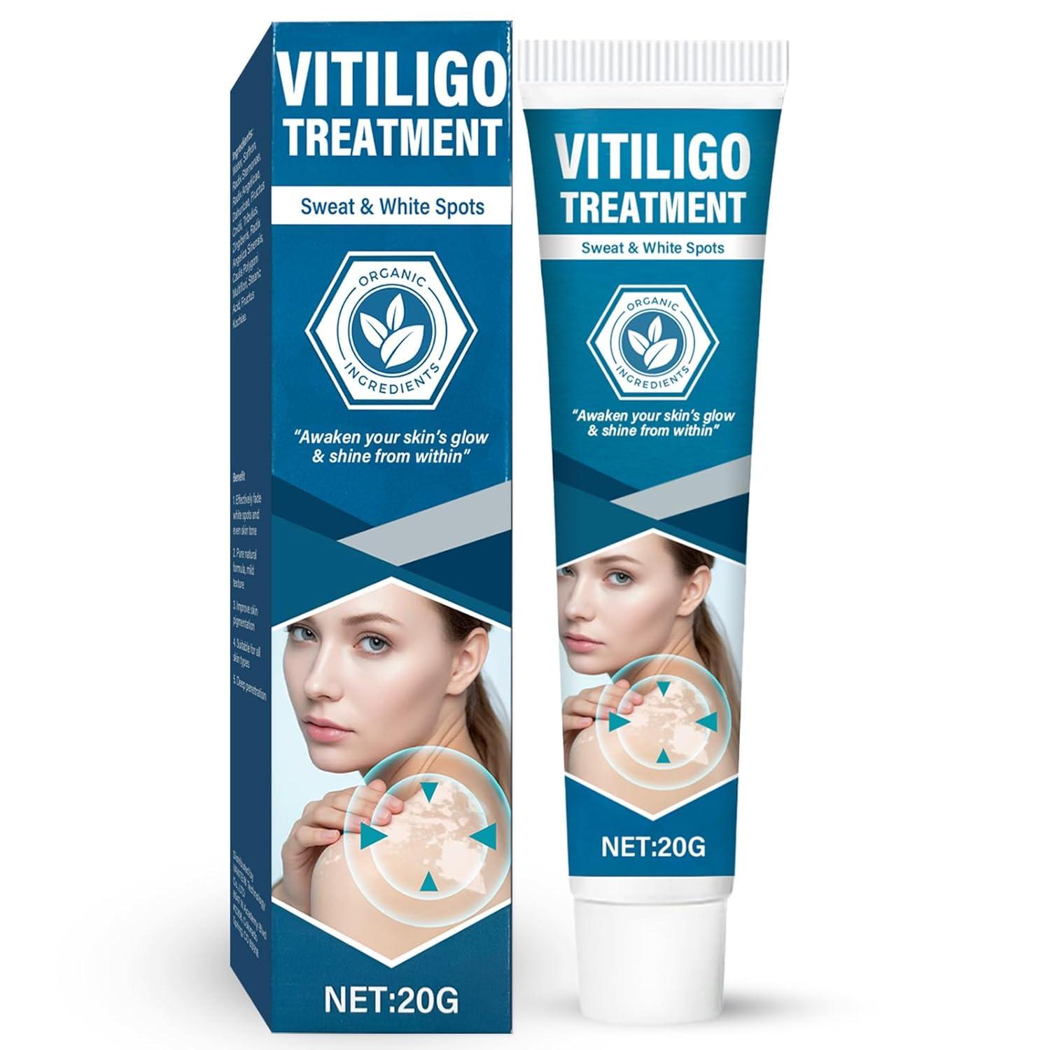 Vitiligo Cream Tested: Surprising Results Reduce White Spots, Boost Pigmentation (Suitable for All)